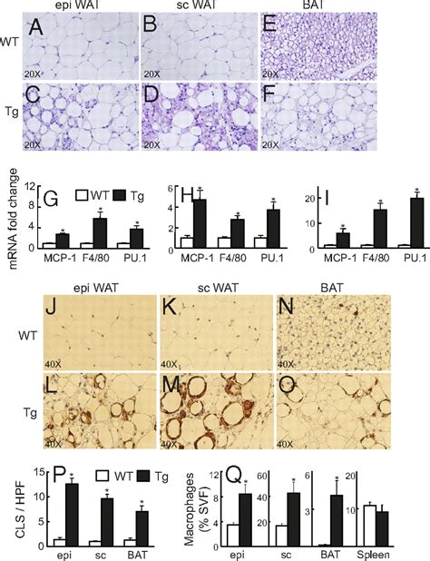 Inflammation And Adipose Tissue Macrophages In Lipodystrophic Mice PNAS