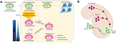 Figure 1 From Primary Mediastinal And Testicular Germ Cell Tumors In