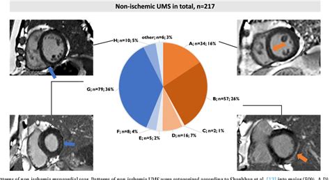 Figure From Unrecognized Myocardial Scar By Late Gadolinium