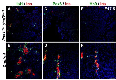 Endocrine Differentiation Of Pancreas Is Impaired In Pdx1tTA TetOMafA