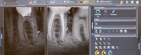 Dentysta Paweł Stomatologia zachowawcza i endodoncja mikroskopowa