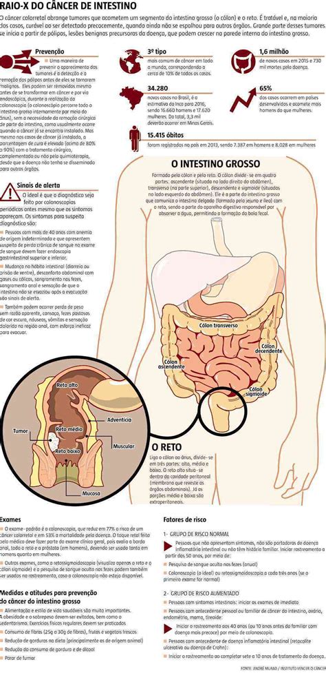 Câncer de intestino está entre os que mais crescem no Brasil mas