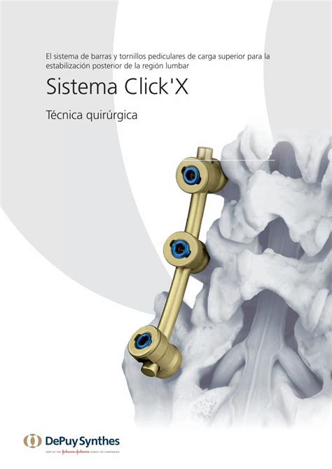 PDF El Sistema De Barras Y Tornillos Pediculares De Carga Synthes