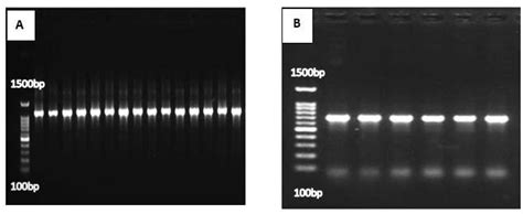 Agarose Gel Electrophoresis Of Pcr Products Of A S Rrna Gene Of