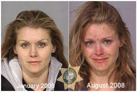 Meth Before And After Pictures Of People On Meth