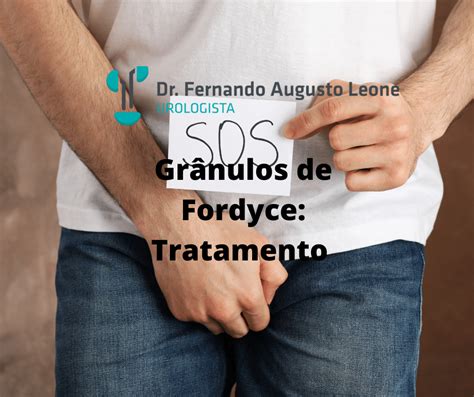 Grânulos de Fordyce Tratamento Dr Leone Urologista BH