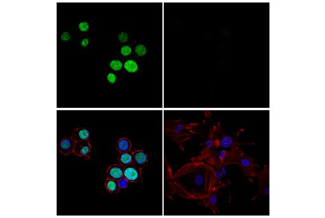 ASCL1 E6Y1B Rabbit MAb Cell Signaling Technology