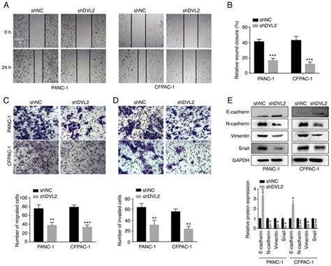 Effects Of Dvl Knockdown On The Migration And Invasion Of Pancreatic