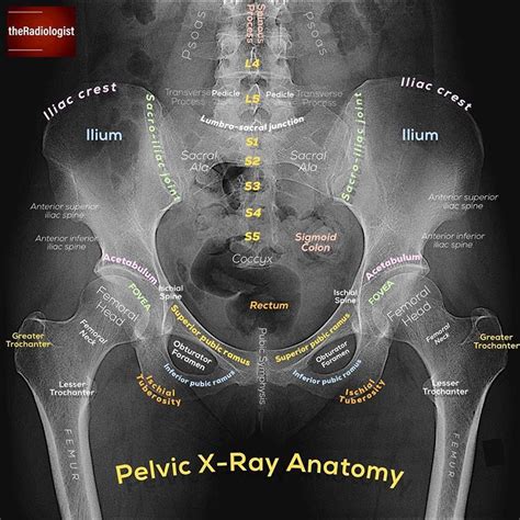 Pelvis Anatomy Xray