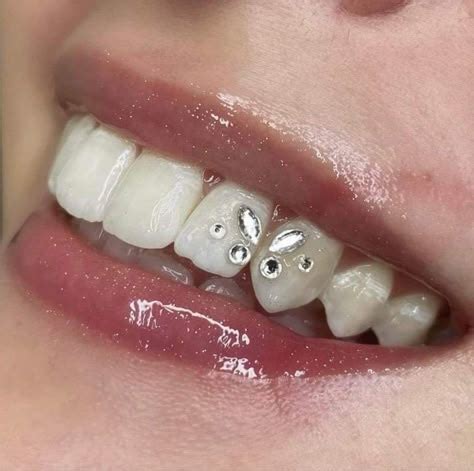Plano De Aula Artes 1 Ano Ensino Fundamental Bncc - Hailey Bieber | Celebrity tooth gems, Celebrities wearing grillz ...