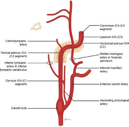 ICA Anatomy | Moyamoya disease, Coarctation of the aorta, Cerebral atrophy