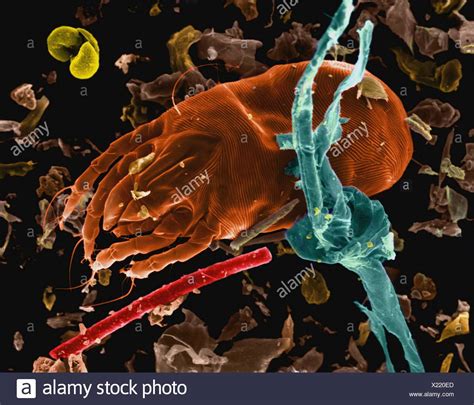 Dermatophagoides Pteronyssinus High Resolution Stock Photography And