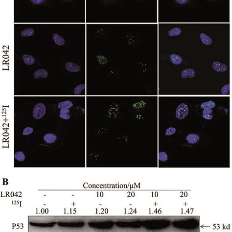 A Lr042 Enhanced The ¹²⁵i Induced Dna Damage Of The Hepg2 Cells The