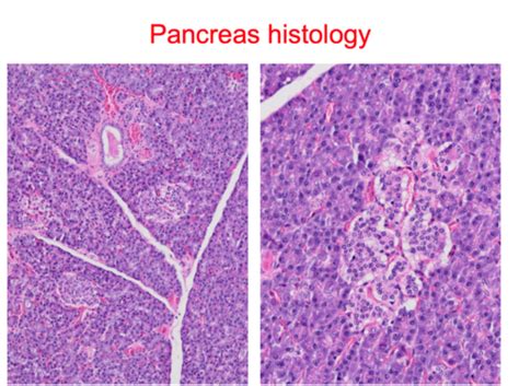 Pancreas L1 Disorders Of The Exocrine Pancreas Flashcards Quizlet