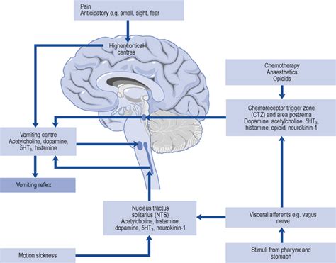 Nausea And Vomiting Basicmedical Key