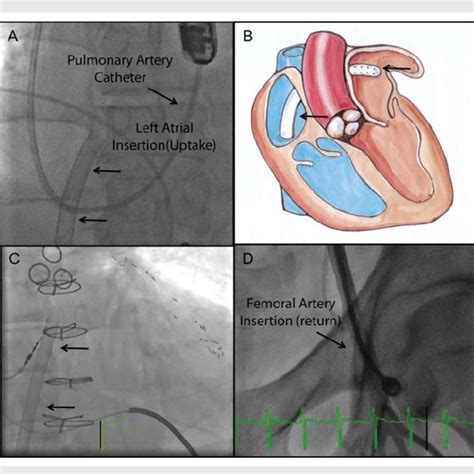 The Figure Displays A Clinical Approach To Consider In A Patient Who Is Download Scientific