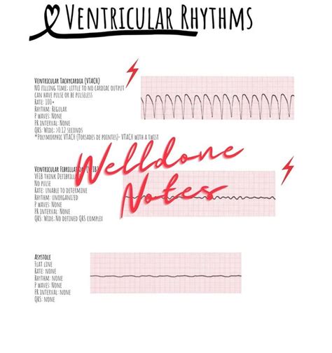 Ekg Basics Study Guide Etsy Study Guide Nursing Notes Ekg