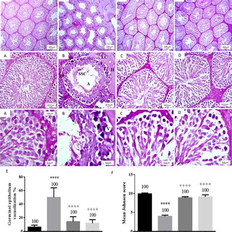 Photomicrographs Of Rat Testes Sections Stained By Periodic