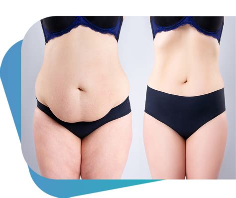 Your Better Wellness Bodytite Liposuction