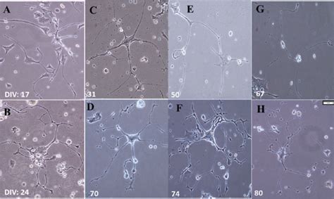 Fructose effects-Differentiation and long-term survival in vitro (A-B ...