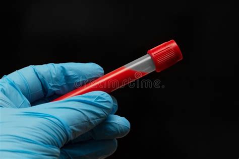 Blood Test Tube Hand In Blue Glove Holds A Test Tube For Analysis In