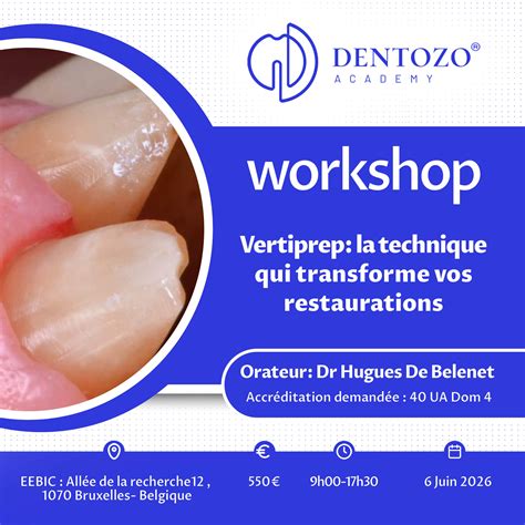 Vertiprep : la technique qui transforme vos restaurations - Dentozo