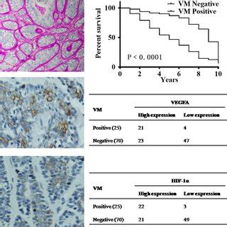 Vegfa Was Involved In Vm Formation Of Sacclm And Sacc Cells In