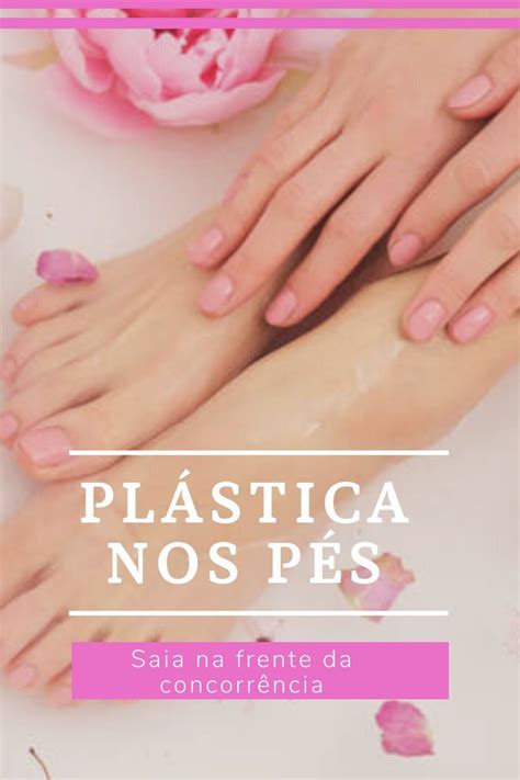 Plástica Nos Pés Página Oficial Plástica Nos Pés