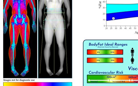 Dexa Scan Results Understanding Your Dexa Scan Report