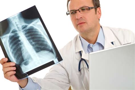 Simptome Ale Cancerului Pulmonar