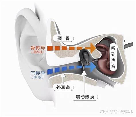 骨传导耳机损伤大脑吗？骨传导耳机到底有什么危害？ 知乎