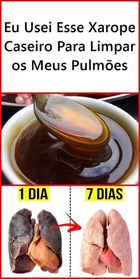 Como Tirar O Catarro Do Peito - Receitas caseiras para acabar com catarro no peito – Artofit