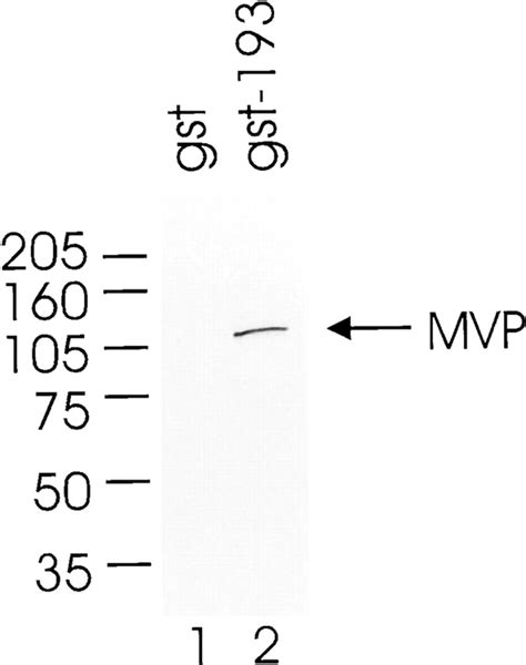 In Vitro Binding Assay Of P193mvp Interaction In Vitrotranslated