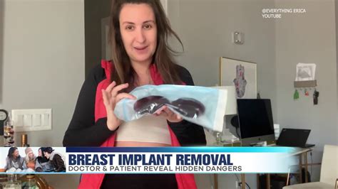 Breast Implant Removal Youtube