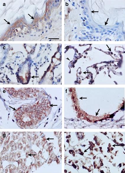 In Situ Hybridization Analysis Of Dermokine Expression In Various