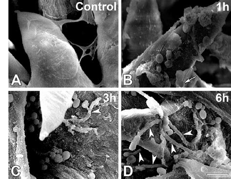 Figure 1 From Invasion Process Of Candida Albicans To Tongue Surface In Early Stages Of