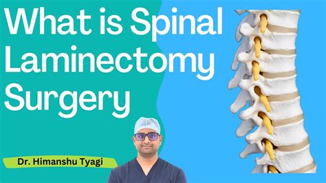 What Is Spinal Laminectomy Surgery Youtube