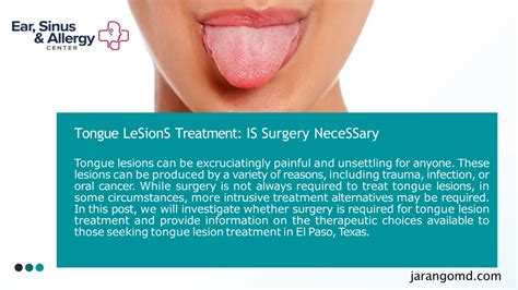 PPT - Tongue Lesions Treatment Is _ Surgery Necessary _ Dr. Jorge J ...