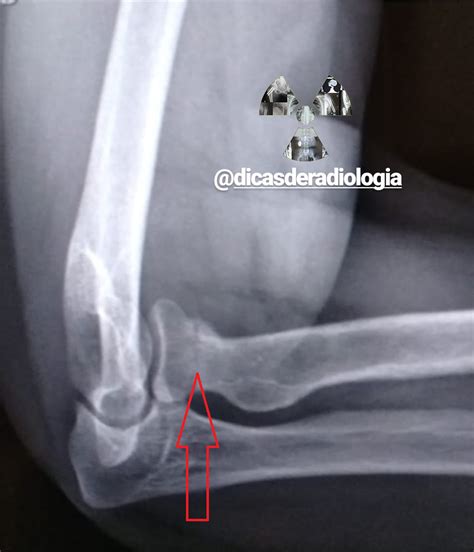 DICAS DE RADIOLOGIA Tudo Sobre Radiologia IMAGENS RADIOLÓGICAS