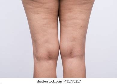 Big Fat Girl With Fat Ass Royalty Free Images Stock Photos