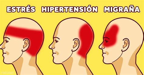 Conoce Los 4 Tipos De Dolores De Cabeza Y Como Tratarlo Con Remedios