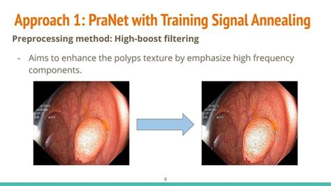 Hcmus At Medico Automatic Polyp Segmentation Task 2020 Pranet And