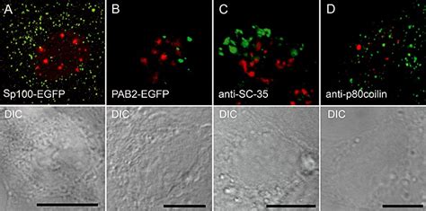 Baculovirus Pml Nbs Nuclear Speckles And Cbs In Hepg Cells A And B