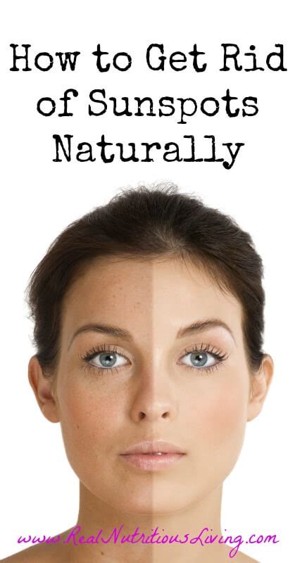 How To Get Rid Of Sunspots Naturally Real Nutritious Living