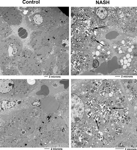 Histology And Transmission Electron Microscopy Of Liver A And B Hot