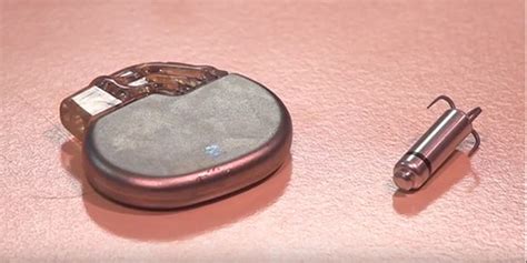 Watch Worlds Smallest Pacemaker Implanted In Sa Patient Life