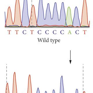 Schematic Representation Of The SEMA3A Protein Location Of The SEMA3A