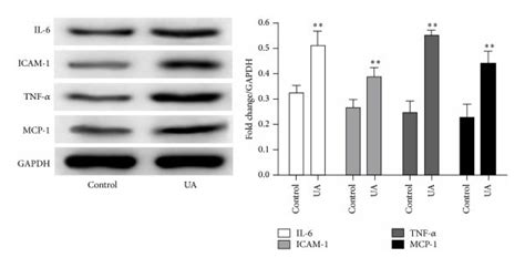 Effect Of Ua On The Expression Of Il 6 Icam 1 Mcp 1 And Tnf α And