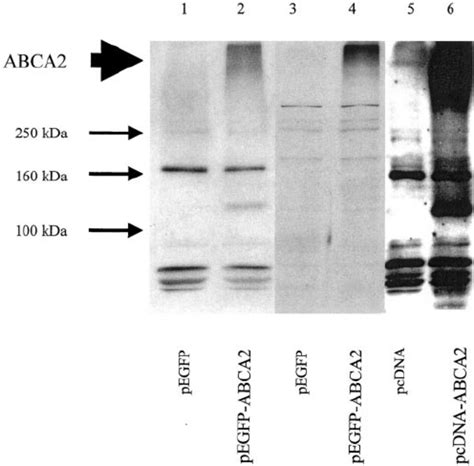 Western Blot Analysis Of Gfp Abca2 And Abca2 In Transfected Hek293