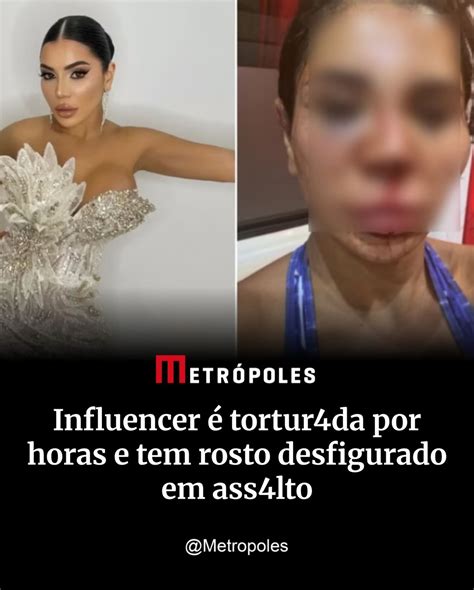 Metrópoles - A influenciadora francesa Soraya Riffy, de 30 anos, foi